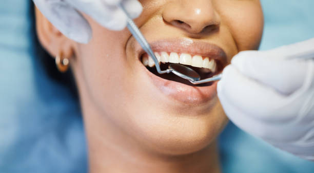 Best Emergency Tooth Extraction in Wetherington, OH