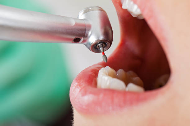 Best Emergency Denture Repair in Wetherington, OH